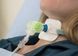 Фильтр дыхательный ТВО Hydro-trach II для пациентов с трахеостомой/ Intersurgical, код 1873000
