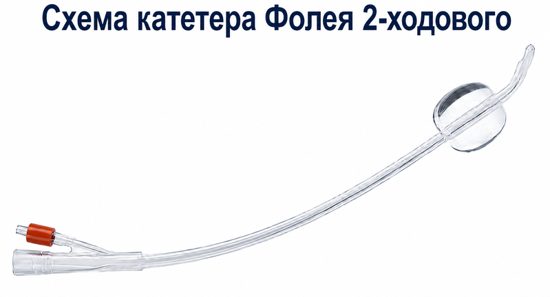 Катетер Фолея 2-ходовий силіконовий СН 18/ Medicare, червоний