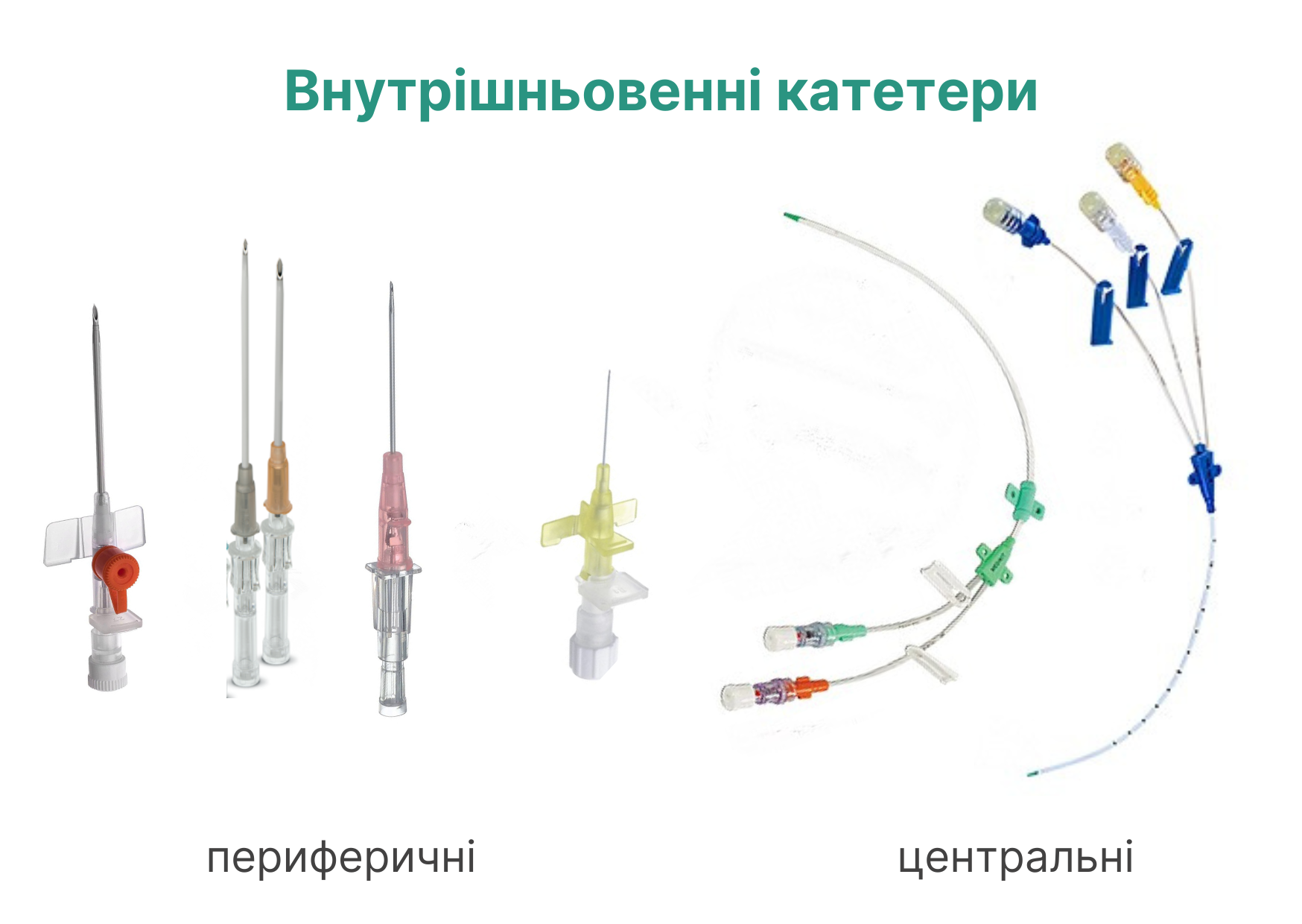 Внутрішньовенні катетери