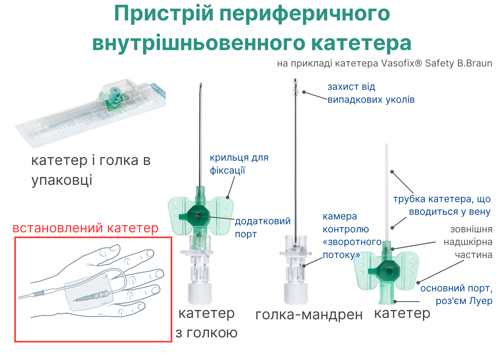 Устрій периферичної венозної канюлі Устрій периферичної венозної канюлі