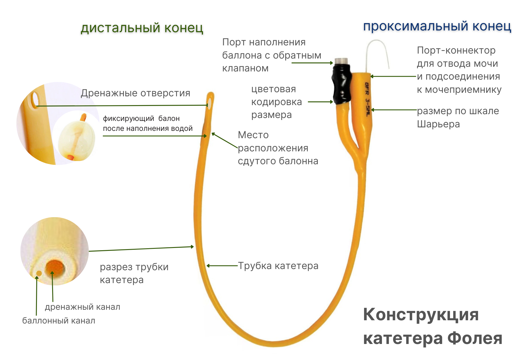 Конструкция катетера Фолея