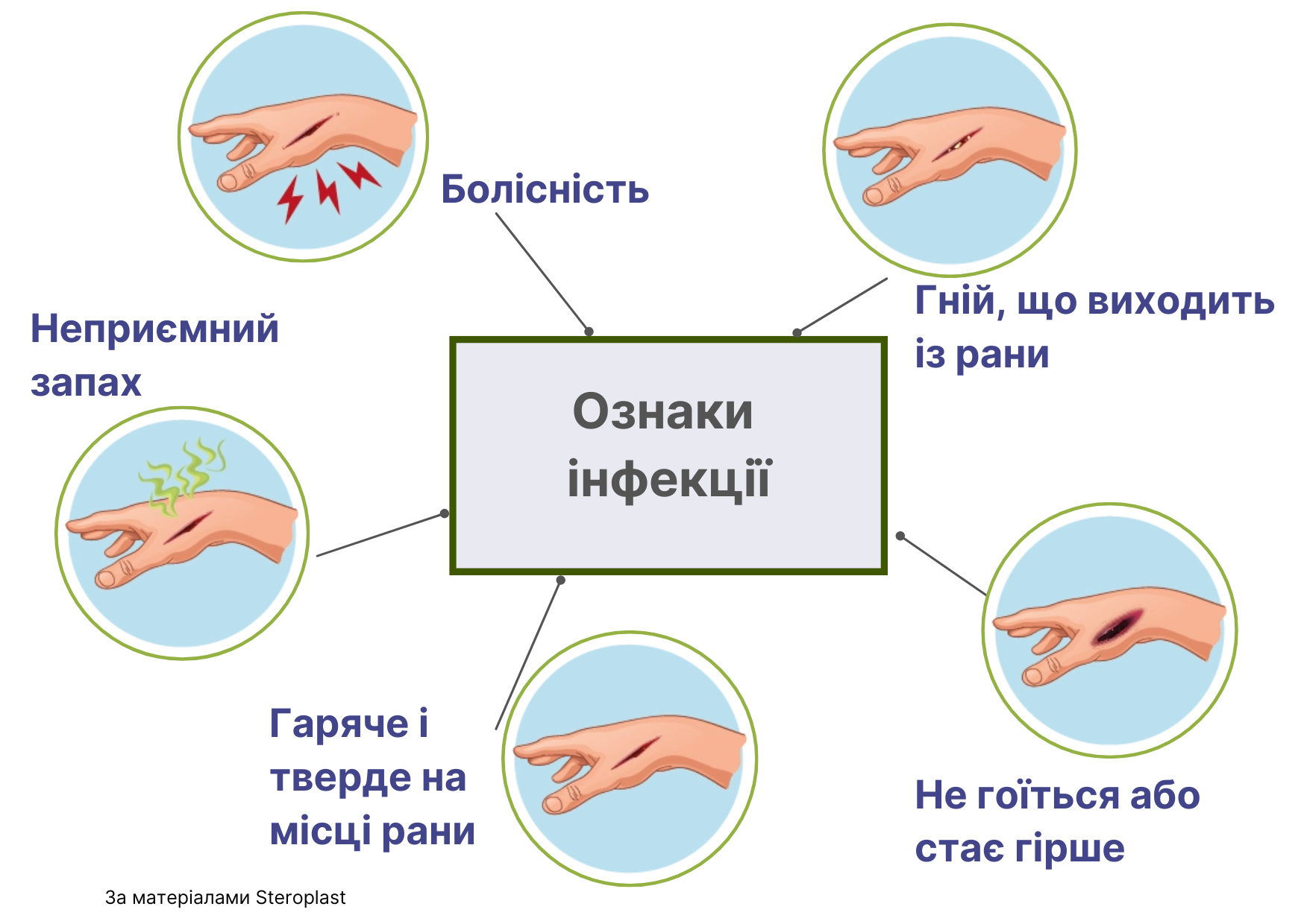 Ознаки інфекції Ознаки інфекції